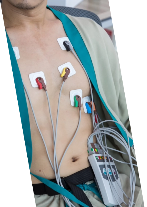 electrocardiogramas